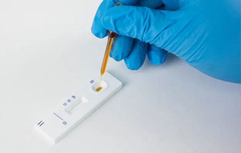 2019-nCoV IgM /IgG Antibody Test Kit from Hipro