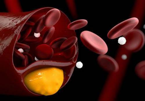 Fluorescence Makes The Cardiovascular