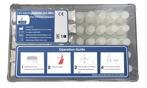 α1-microglobulin（α1-MG）Beta Microglobulin Test