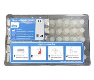 β2-microglobulin (β2-MG) Test