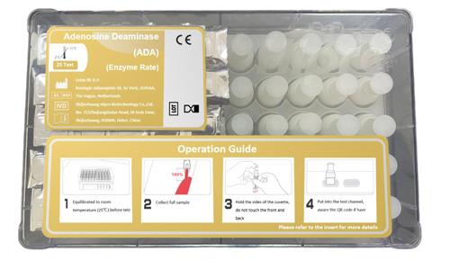 Adenosine Deaminase Test Kit