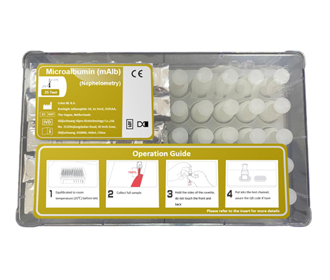 Microalbumin (mAlb) Test