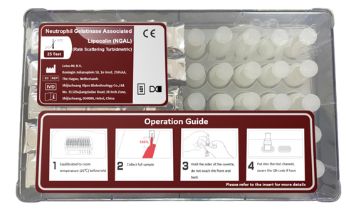 NGAL Test Kit, Neutrophil Gelatinase Associated Lipocalin Test