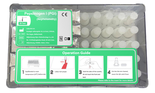 Early Warning Indicator of Gastric Cancer: Pepsinogen (PG)